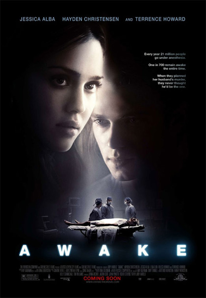 Poster Awake - Anestesia cosciente