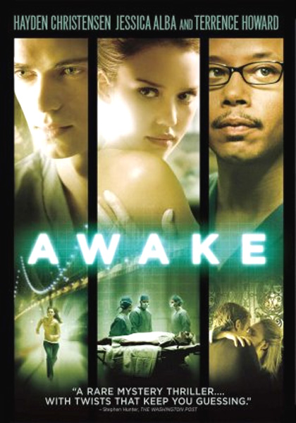 Poster Awake - Anestesia cosciente